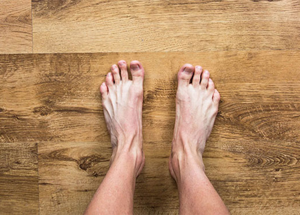 Viêm bao hoạt dịch ngón chân cái khiến bạn thấy đau đớn khó chịu