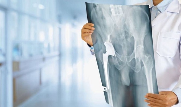 Phóng xạ khi chụp X-quang có hại cho sức khỏe không?