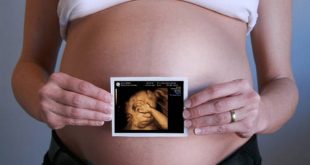 Siêu âm thai kỳ giúp mẹ bầu sớm phát hiện dị tật ở trẻ