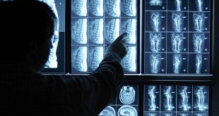 Những điểm lợi và hại của phương pháp chụp X- quang