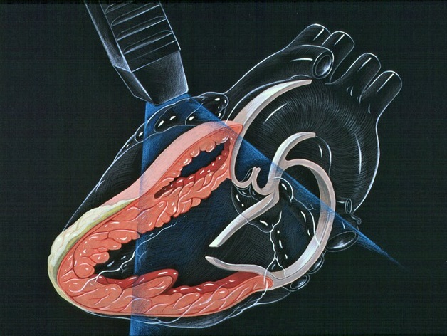 Tìm hiểu về kỹ thuật siêu âm tim trong chẩn đoán hình ảnh